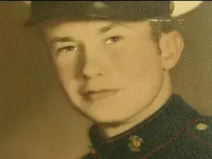 Legionnaires' Disease